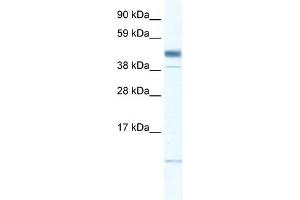 WB Suggested Anti-ZMAT1 Antibody Titration: 0. (ZMAT1 anticorps  (Middle Region))