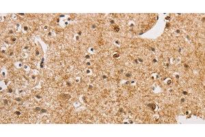 Immunohistochemistry of paraffin-embedded Human brain using ARHGEF5 Polyclonal Antibody at dilution of 1:50 (ARHGEF5 anticorps)