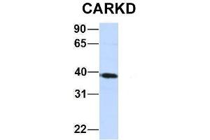 Host:  Rabbit  Target Name:  CARKD  Sample Type:  Jurkat  Antibody Dilution:  1. (Carkd anticorps  (Middle Region))