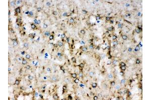 Alpha Internexin was detected in paraffin-embedded sections of rat brain tissues using rabbit anti- Alpha Internexin Antigen Affinity purified polyclonal antibody (Catalog # ) at 1 µg/mL. (INA anticorps  (AA 71-161))