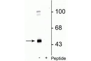 Western blot of rat cortical lysate showing specific immunolabeling of the ~45 kDa GABAA γ2 protein phosphorylated at Ser327 in the first lane (-). (GABRG2 anticorps  (pSer327))