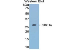 Western Blotting (WB) image for anti-Retinoic Acid Receptor, alpha (RARA) (AA 237-459) antibody (ABIN1860408)