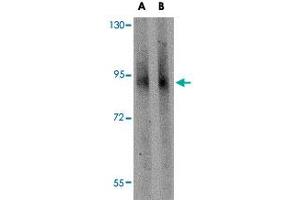 Western blot analysis of GLE1 in mouse brain tissue lysate with GLE1 polyclonal antibody  at (A) 1 and (B) 2 ug/mL . (GLE1 anticorps  (C-Term))