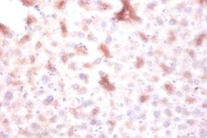 Immunohistochemistry of paraffin-embedded mouse liver tissue using ABIN7150677 at dilution of 1:100
