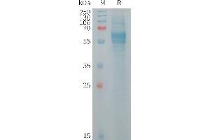 Human F Protein, His Tag on SDS-PAGE under reducing condition.