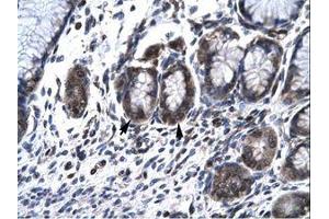 Image no. 1 for anti-Hematopoietic Cell-Specific Lyn Substrate 1 (HCLS1) (AA 28-77) antibody (ABIN6735791) (HCLS1 anticorps  (AA 28-77))