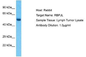 Host: Rabbit Target Name: RBPJL Sample Type: Lymph Tumor lysates Antibody Dilution: 1. (RBPJL anticorps  (N-Term))