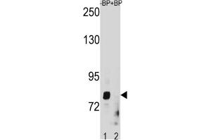 Western Blotting (WB) image for anti-Zinc Finger, Matrin-Type 1 (ZMAT1) antibody (ABIN3004468) (ZMAT1 anticorps)