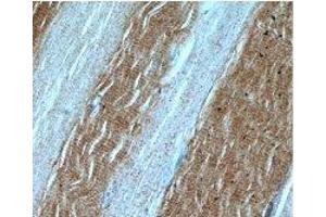 Immunohistochemical of paraffin-embedded human skeletal muscle using (LDHA antibody) at dilution of 1:50. (Lactate Dehydrogenase A anticorps)