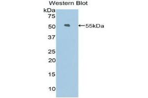 Western Blotting (WB) image for anti-Kinesin Family Member 5A (KIF5A) (AA 823-1027) antibody (ABIN1859531)
