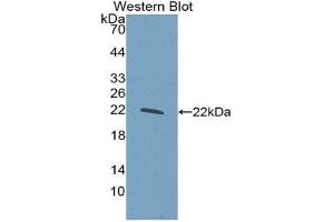 Western Blotting (WB) image for anti-Glucokinase (Hexokinase 4) Regulator (GCKR) (AA 320-499) antibody (ABIN3206778) (GCKR anticorps  (AA 320-499))