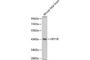 Western blot analysis of extracts of Mouse fetal brain using NPY1R Polyclonal Antibody. (NPY1R anticorps)