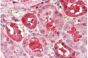 Human Kidney: Formalin-Fixed, Paraffin-Embedded (FFPE)