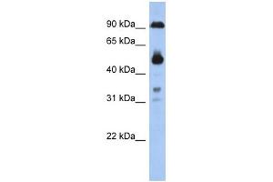 CCDC144B antibody used at 1 ug/ml to detect target protein. (CCDC144B anticorps  (Middle Region))