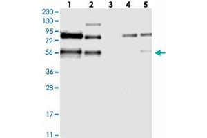 Western blot analysis of Lane 1: RT-4, Lane 2: U-251 MG, Lane 3: Human Plasma, Lane 4: Liver, Lane 5: Tonsil with TJAP1 polyclonal antibody . (TJAP1 anticorps)