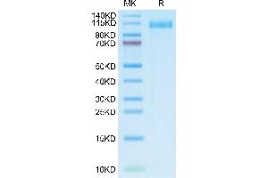 SARS-CoV-2 Spike S1 (BA.2.12.1 - Omicron) protein (His tag)