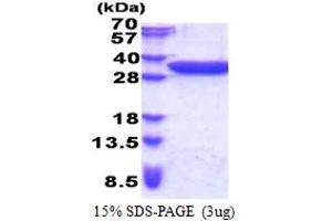 SDS-PAGE (SDS) image for Coiled-Coil Domain Containing 44 (CCDC44) (AA 61-297) protein (His tag) (ABIN5853335)