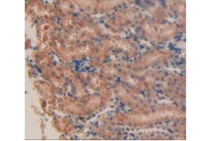 IHC-P analysis of Mouse Kidney Tissue, with DAB staining. (PD-L1 anticorps  (AA 34-241))