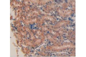 IHC-P analysis of Mouse Kidney Tissue, with DAB staining.