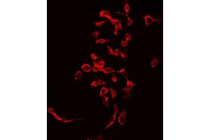 ABIN6268951 staining Hela by IF/ICC. (CD247 anticorps  (C-Term))