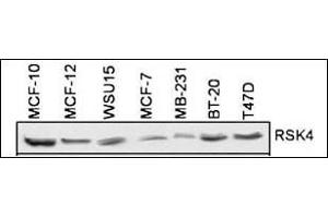 RSK4 Antibody (N-term) (ABIN1882127 and ABIN2842047) is used to detect RSK4 in 7 different cell lines. (RPS6KA6 anticorps  (N-Term))