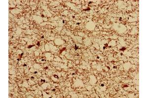 IHC image of ABIN7155274 diluted at 1:800 and staining in paraffin-embedded human brain tissue performed on a Leica BondTM system.