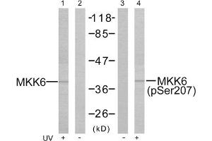 Western blot analysis of the extracts from MDA-MB- 435 cells treated or untreated with UV using MKK3 (epitope around residue 207) Antibody (ABIN5976000) and MKK6 (Phospho-Ser207) Antibody (ABIN59760003). (MAP2K3 anticorps  (pSer189, Ser207))