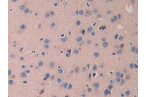 DAB staining on IHC-P; Samples: Mouse Cerebrum Tissue (LAMB2 anticorps  (AA 1498-1716))