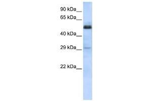 Western Blotting (WB) image for anti-Sex Comb On Midleg-Like 1 (SCML1) antibody (ABIN2458173) (SCML1 anticorps)
