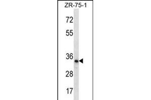 TLCD2 Antibody (C-term) (ABIN656296 and ABIN2845603) western blot analysis in ZR-75-1 cell line lysates (35 μg/lane). (TLCD2 anticorps  (C-Term))
