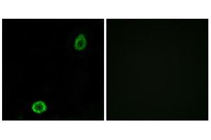 Immunofluorescence analysis of A549 cells, using ABCA13 antibody. (ABCA13 anticorps  (Internal Region))