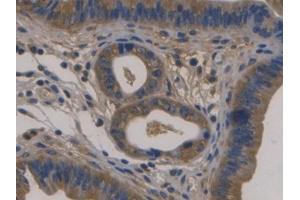 DAB staining on IHC-P; Samples: Mouse Uterus Tissue) (Fibulin 1 anticorps  (AA 399-578))