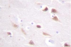 Image no. 2 for anti-Casein Kinase 2, beta (CSNK2B) antibody (ABIN272014) (CSNK2B anticorps)