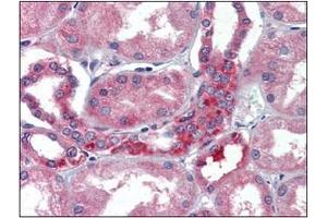 Immunohistochemistry (IHC) image for anti-Ribonuclease/angiogenin Inhibitor 1 (RNH1) (AA 7-461) antibody (ABIN400852)