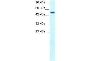 WB Suggested Anti-FLJ14768 Antibody Titration: 1. (FIZ1 anticorps  (C-Term))