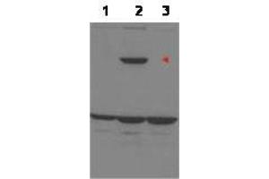 Image no. 1 for anti-Protein Phosphatase 1, Regulatory Subunit 13B (PPP1R13B) (Internal Region) antibody (ABIN291763) (PPP1R13B anticorps  (Internal Region))