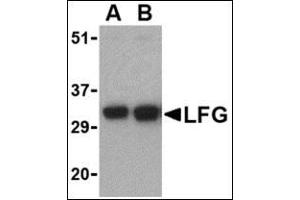 Western blot analysis of LFG in EL4 cell lysate with this product at (A) 0.