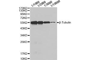 Western blot analysis of HeLa cell using β-tubulin antibody at different dilution. (TUBB anticorps)
