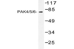 Image no. 1 for anti-P21-Activated Kinase 4 (PAK4) antibody (ABIN317882) (PAK4 anticorps)