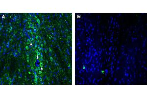 Expression of OCT2 in rat medial septum nucleus.