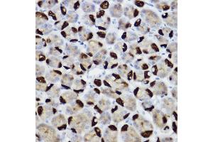 Immunohistochemistry of paraffin-embedded rat stomach using BNIP3 Rabbit pAb (ABIN6127502, ABIN6137620, ABIN6137621 and ABIN6221337) at dilution of 1:150 (40x lens). (BNIP3 anticorps  (AA 1-164))