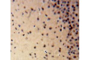 Used in DAB staining on fromalin fixed paraffin-embedded Brain tissue (LIG1 anticorps  (AA 568-875))