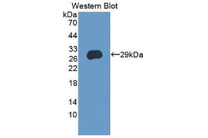 Western blot analysis of the recombinant protein. (CRISP3 anticorps  (AA 21-243))