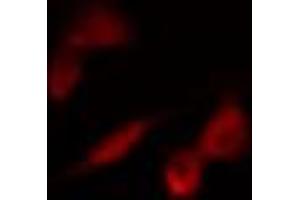 ABIN6274266 staining 293 cells by IF/ICC.