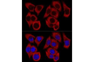 Confocal immunofluorescence analysis of HeLa cells using RPL36 Polyclonal Antibody (ABIN6129105, ABIN6147141, ABIN6147142 and ABIN6223749) at dilution of 1:200. (RPL36 anticorps  (AA 1-105))