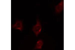 ABIN6274870 staining HepG2 by IF/ICC.