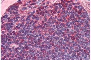 Human Colon, MALT (formalin-fixed, paraffin-embedded) stained with IL7R antibody ABIN351552 at 5 ug/ml followed by biotinylated goat anti-rabbit IgG secondary antibody ABIN481713, alkaline phosphatase-streptavidin and chromogen. (IL7R anticorps  (C-Term))