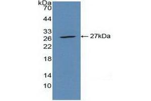 Detection of Recombinant ACTa2, Human using Polyclonal Antibody to Actin Alpha 2, Smooth Muscle (ACTa2)