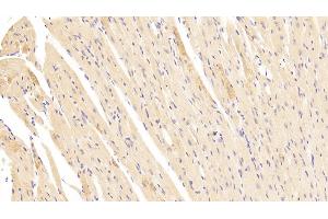 Detection of LAMb2 in Mouse Heart Tissue using Polyclonal Antibody to Laminin Beta 2 (LAMb2)