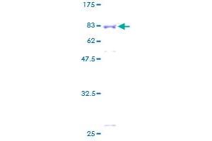 Image no. 1 for Amyloid beta (A4) Precursor Protein-Binding, Family B, Member 3 (APBB3) (AA 1-486) protein (GST tag) (ABIN1345290)